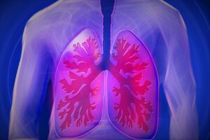 chronic obstructive pulmonary disease